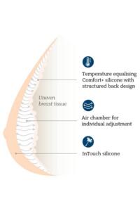 Balance Adapt Air Medium Delta Breast Shaper Alt 2