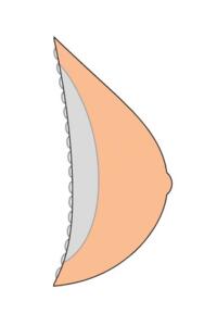 Contact 3S Breast Form Alt 1